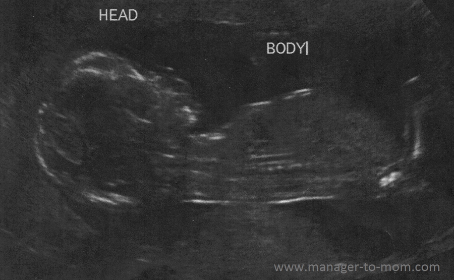 early ultrasound dating wrong
